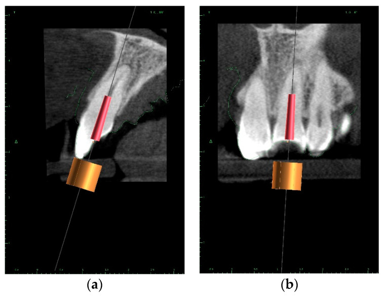 Figure 11