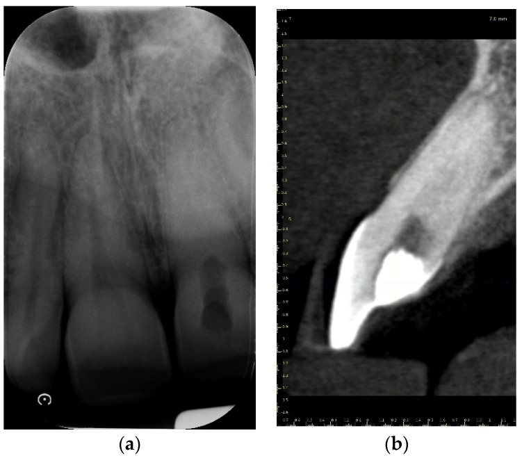 Figure 16