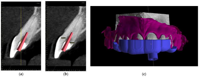 Figure 17