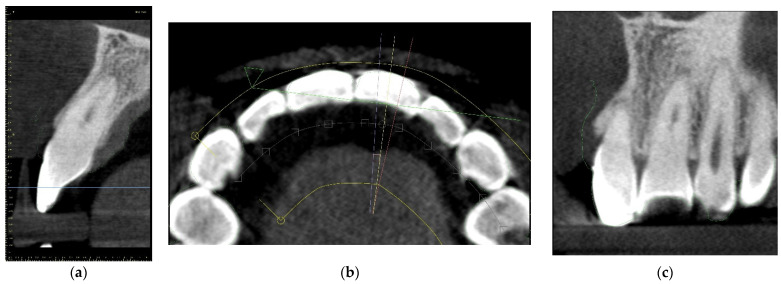 Figure 9