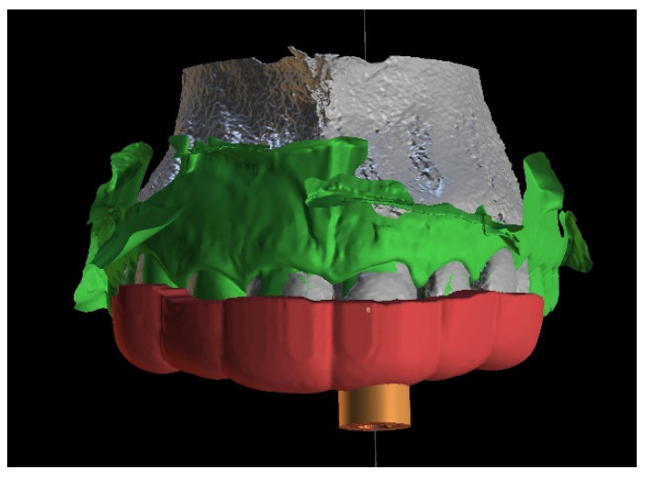 Figure 4