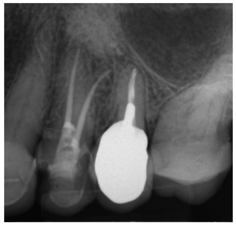 Figure 23