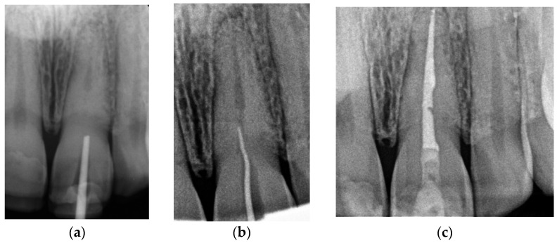 Figure 15