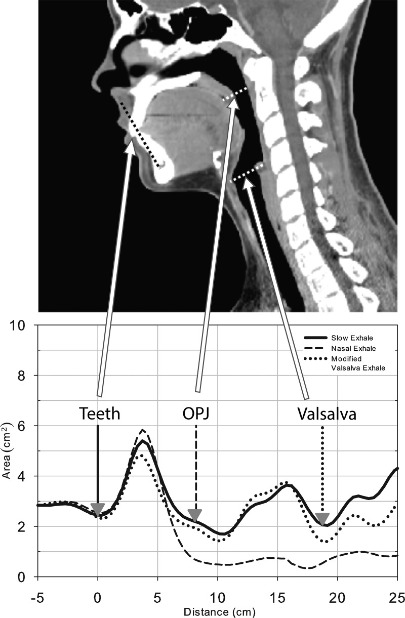 FIG. 2.