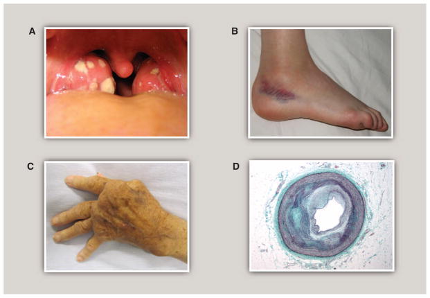 Fig. 1