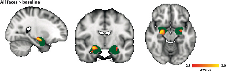 Fig 5