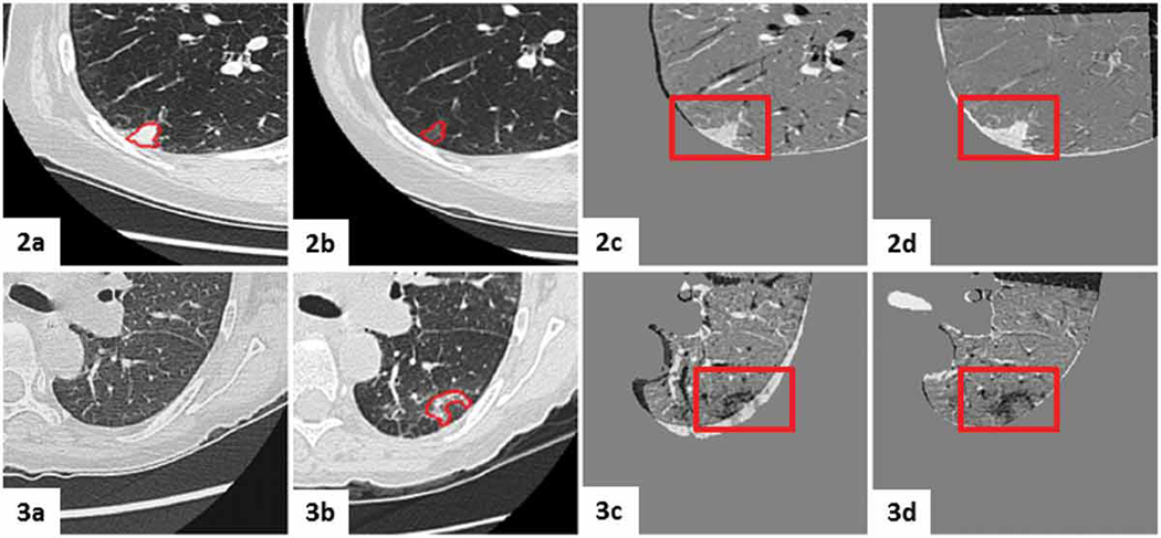 Figure 14.