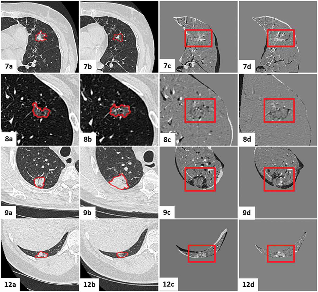 Figure 16.