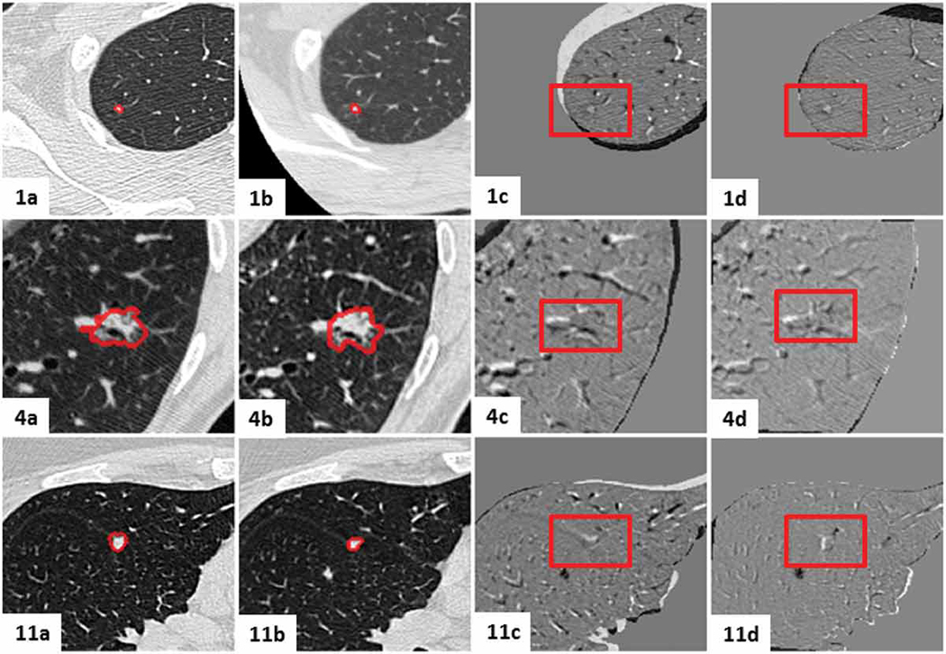 Figure 15.