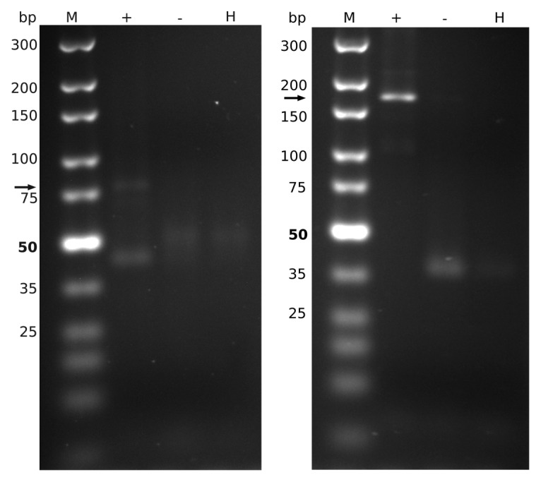 graphic file with name rna-11-3-g4.jpg