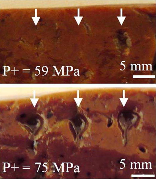 Fig. 11