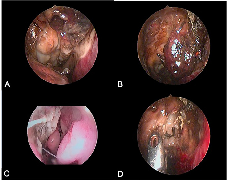 Fig. 2