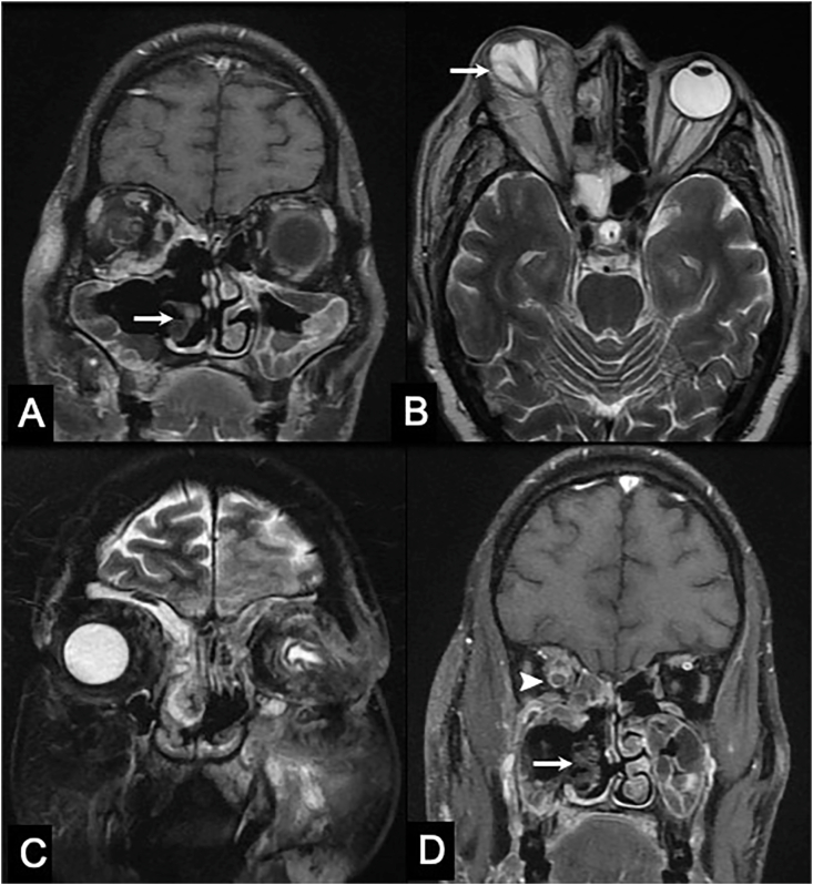 Fig. 3