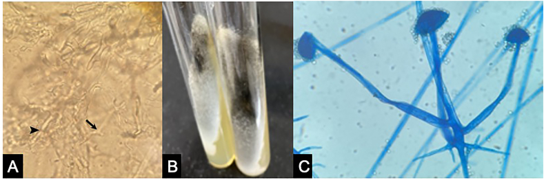 Fig. 1