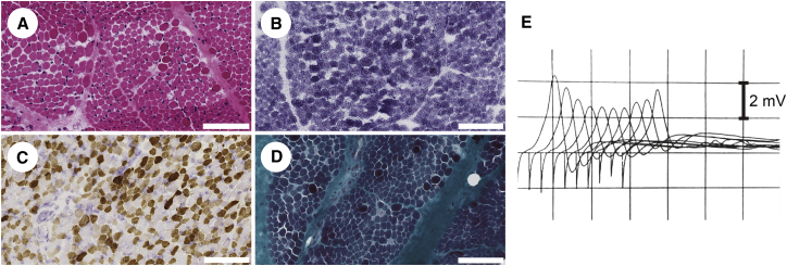 Figure 1