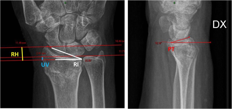 Fig. 2