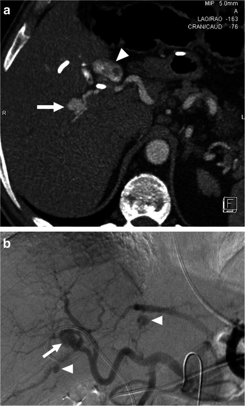 Fig. 10