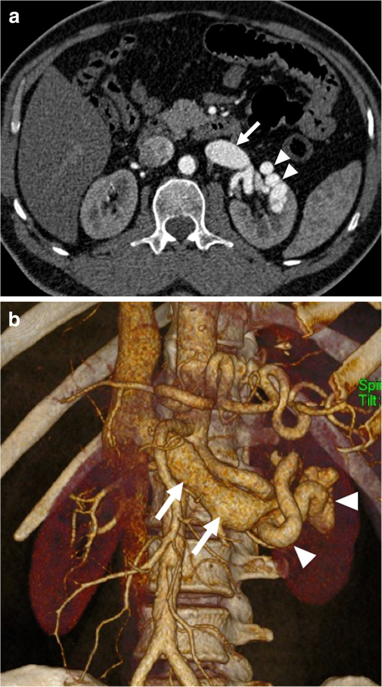 Fig. 16