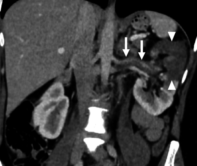 Fig. 11