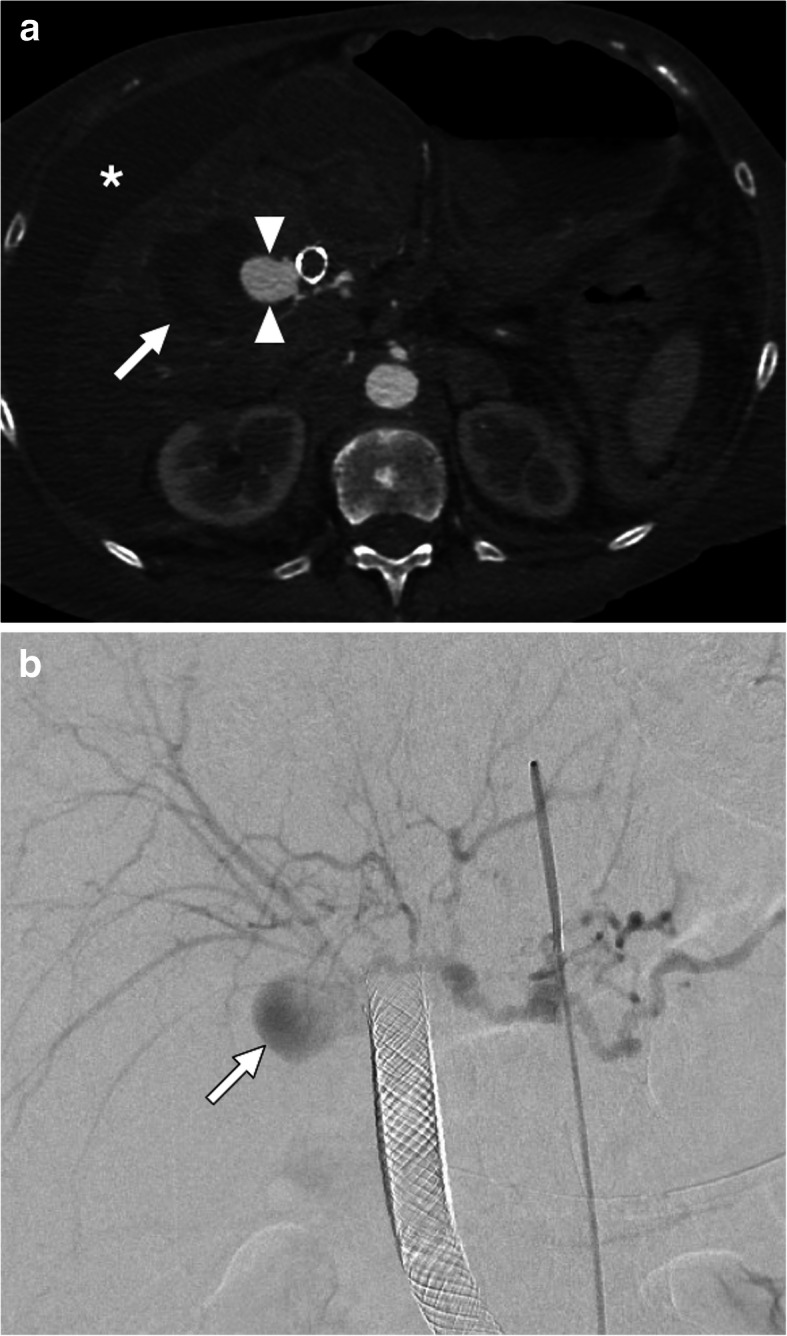 Fig. 9