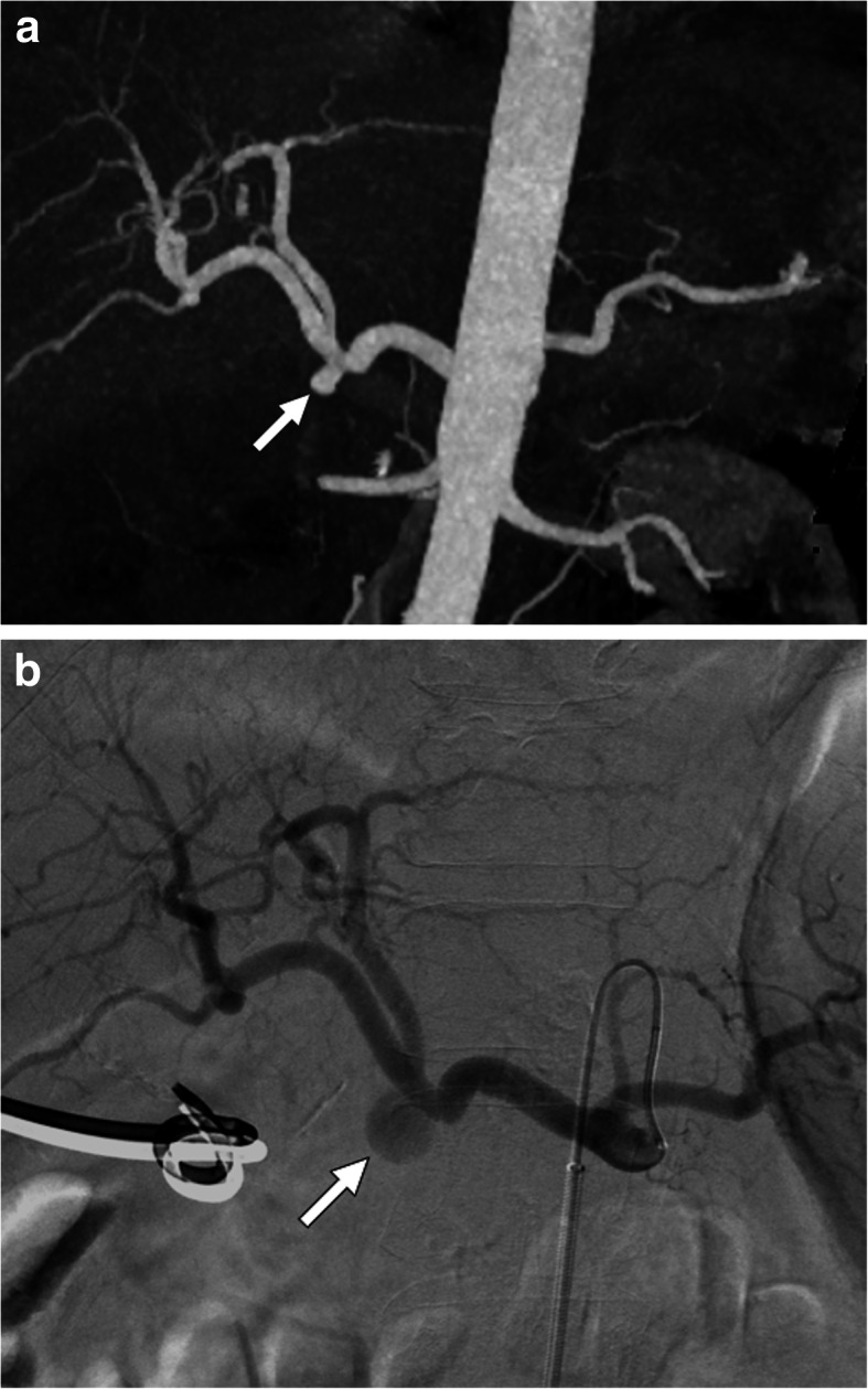 Fig. 29