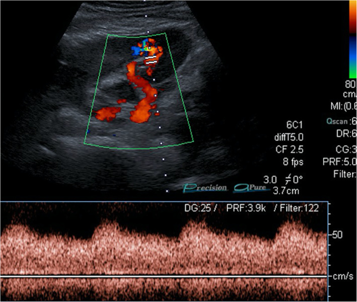 Fig. 15