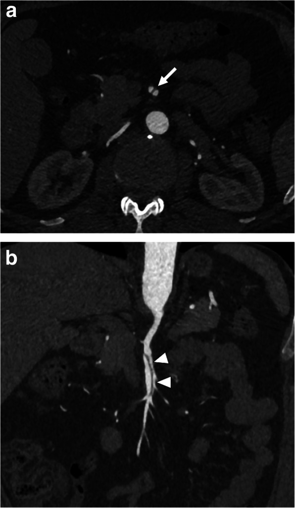 Fig. 22