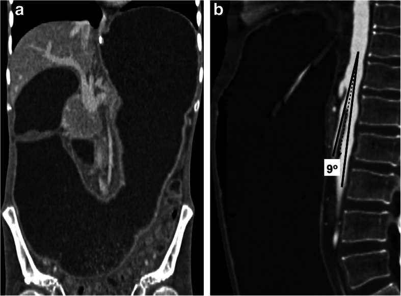 Fig. 24