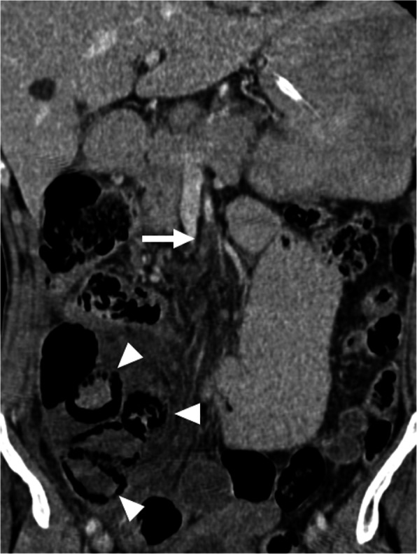 Fig. 21