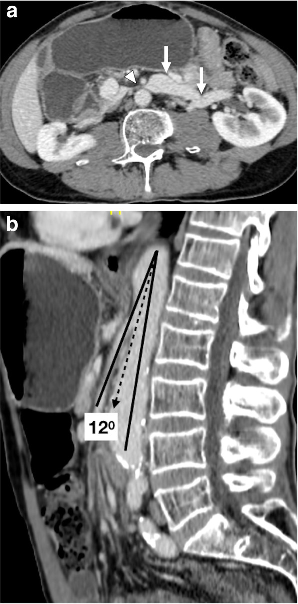 Fig. 19