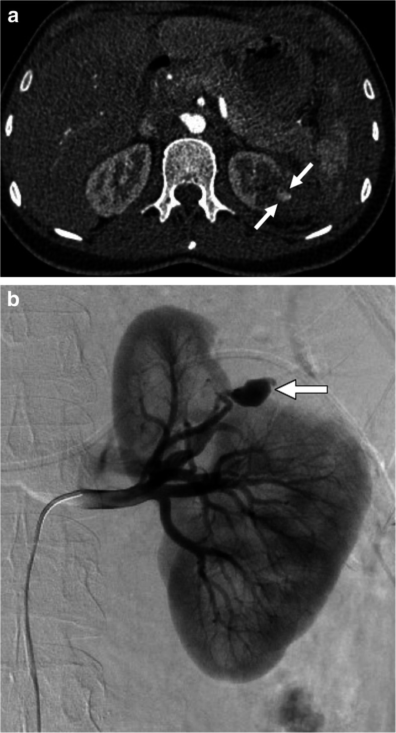 Fig. 14