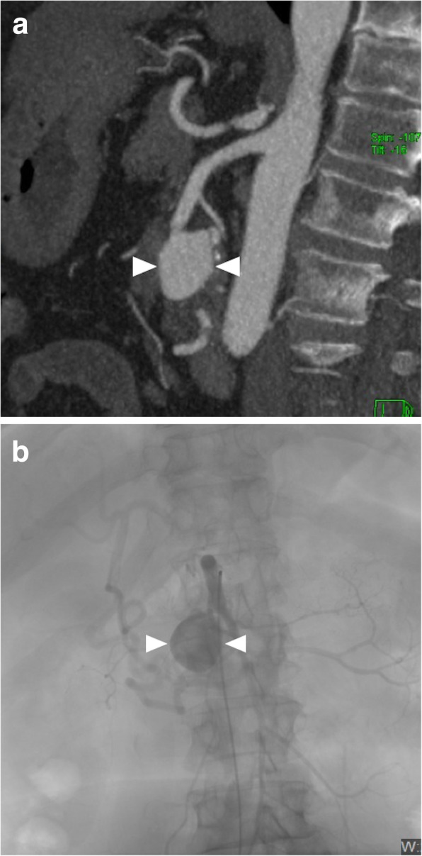 Fig. 23