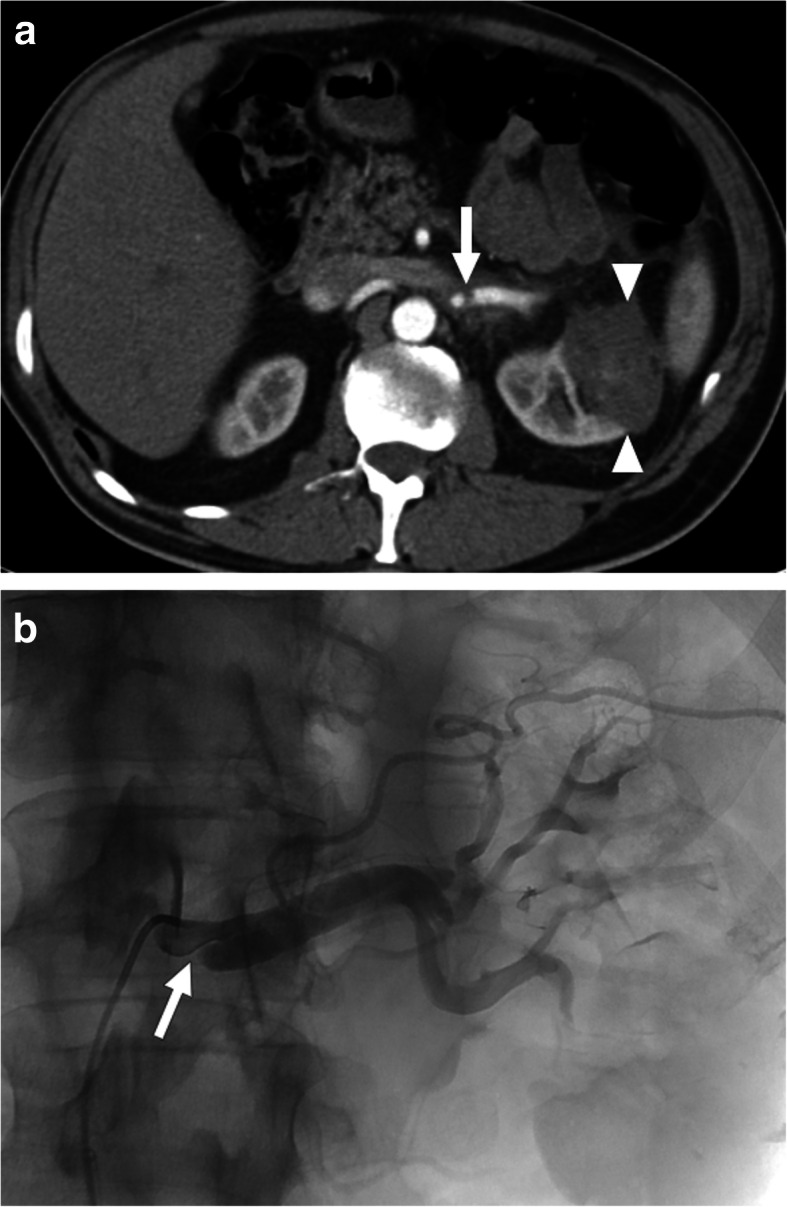 Fig. 12