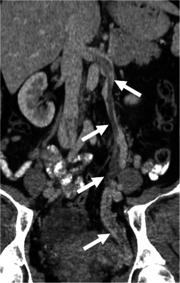 Fig. 20