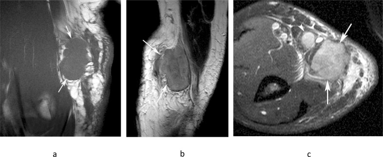 Figure 14.