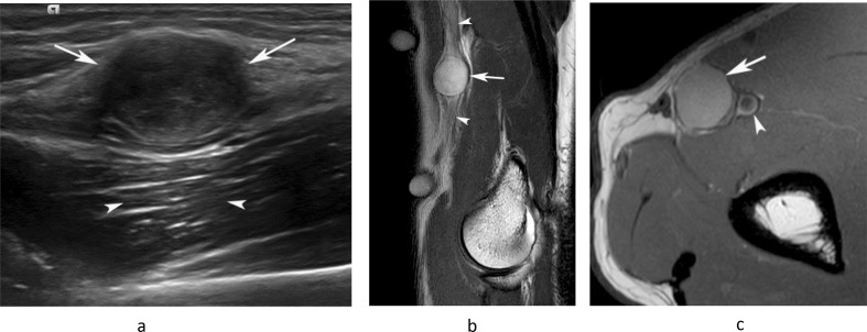 Figure 11.