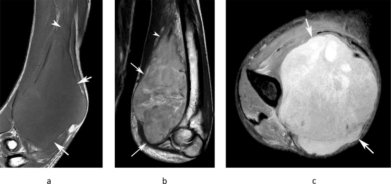 Figure 13.