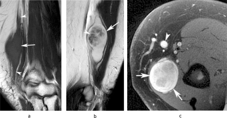 Figure 12.