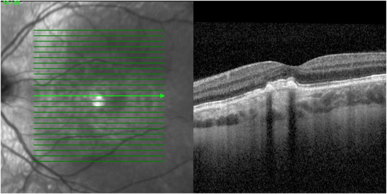 Fig. 3