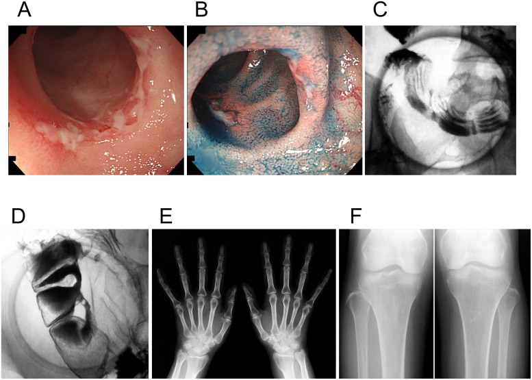 Fig 2