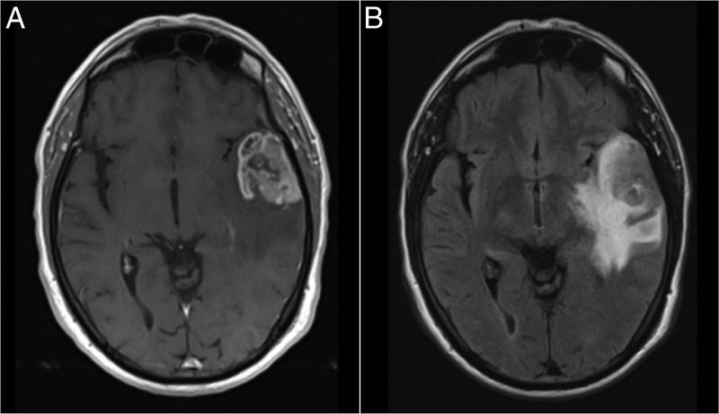 Figure 1