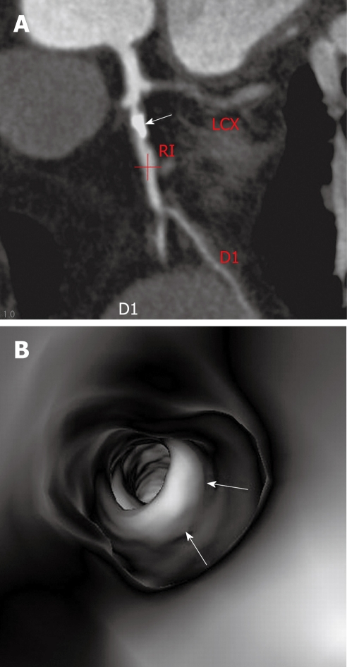 Figure 9