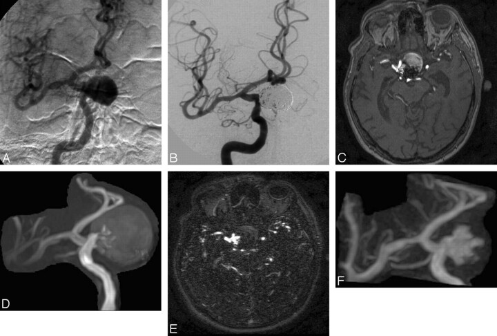 Fig 2.