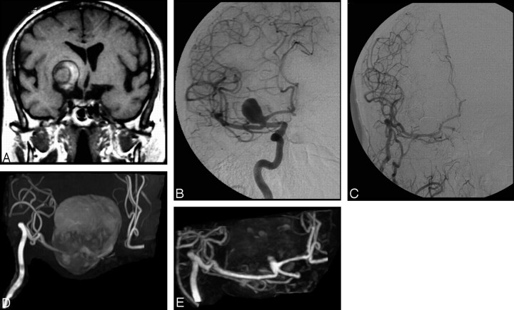 Fig 1.