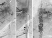 Fig 6.