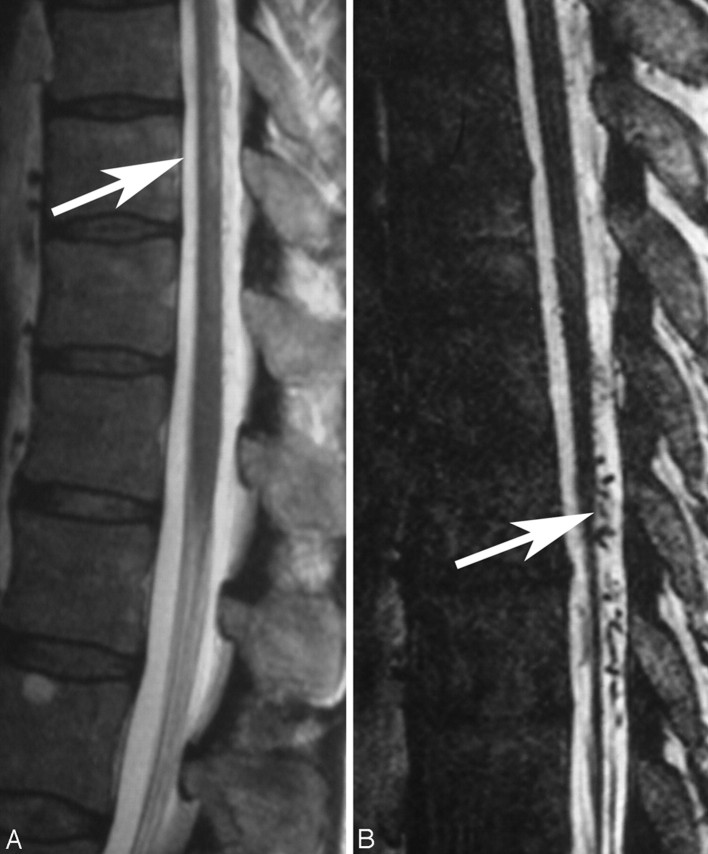 Fig 3.