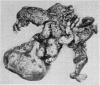 141
