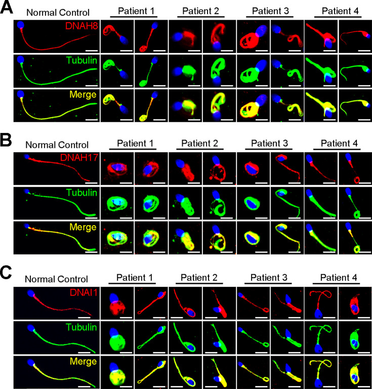 Figure 5—figure supplement 1.