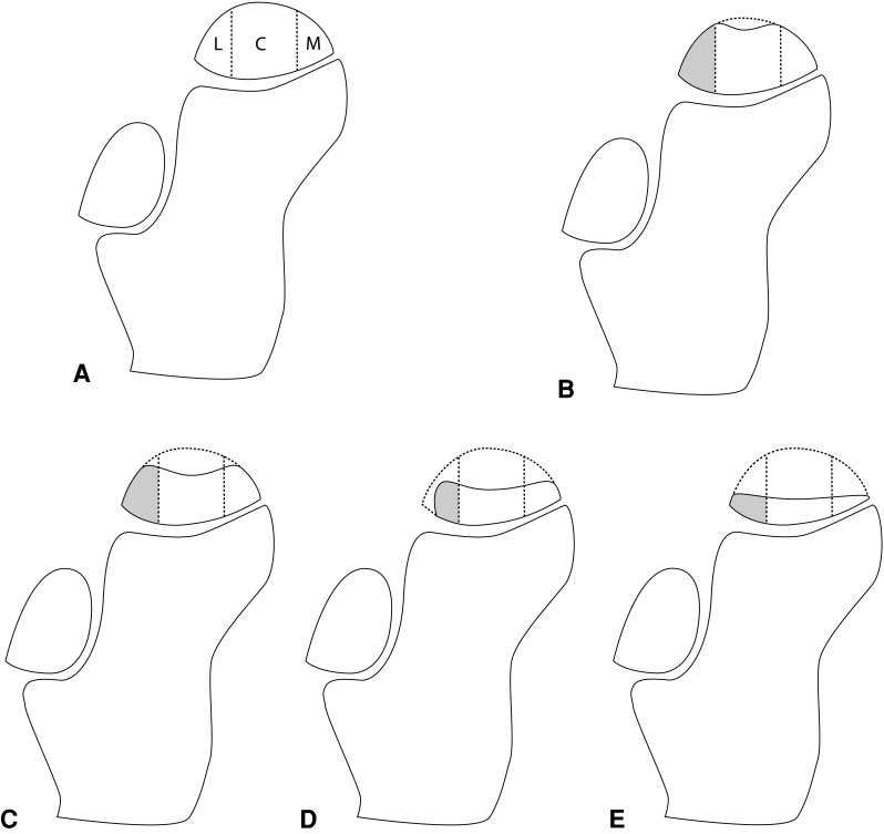 Fig. 1 A–E