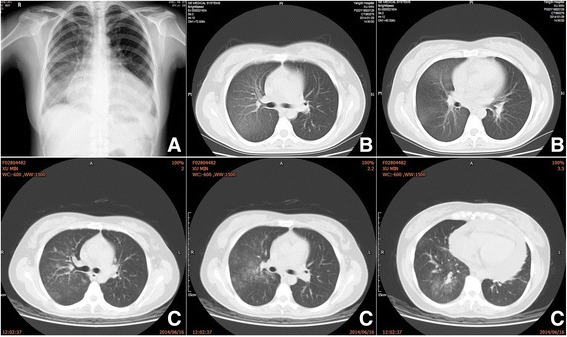 Fig. 2